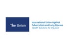 The Union